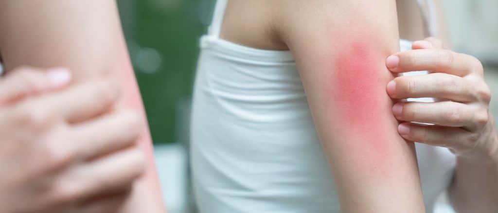 Autoimmune Skin Disorders - DermAlly | Specialist Skin Clinic