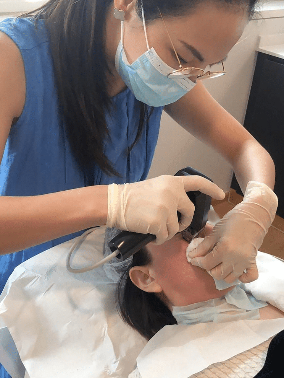Doctor performing Fractional Microneedling Radiofrequency (RF) Treatment Procedure - Laser Acne Scar Removal in Singapore