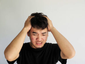 Frustrated man with Fungal Acne
