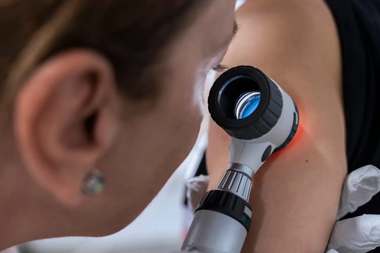 Patient undergoing skin cancer screening
